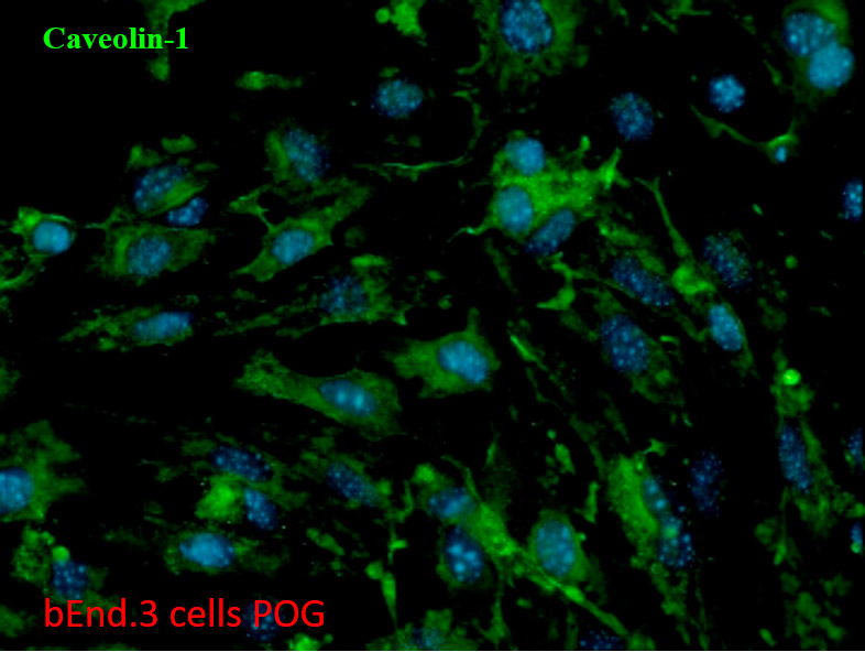 Marcatge de Caveolina-1 en cèl·lules bEnd.3