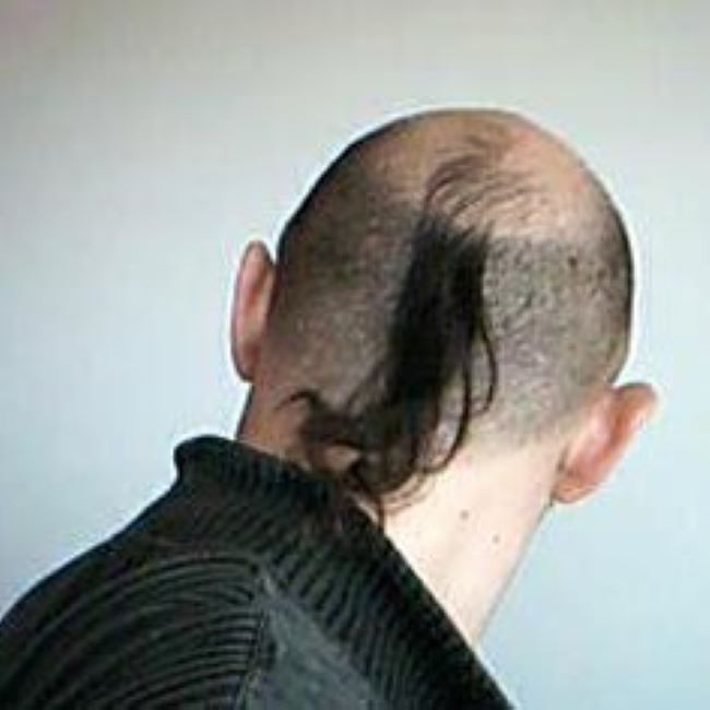 Fotografía de Doctor MOLINER MILHAU, XAVIER